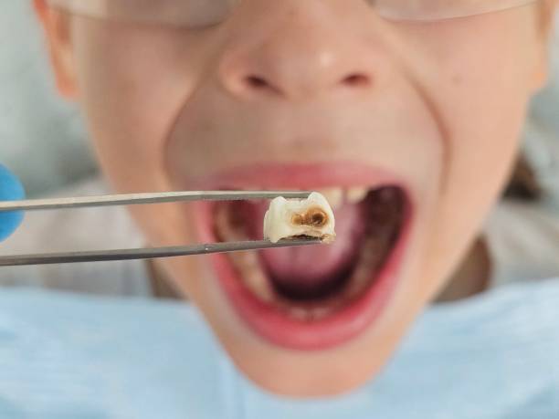 Best Pediatric Emergency Dentist in Sebastian, FL